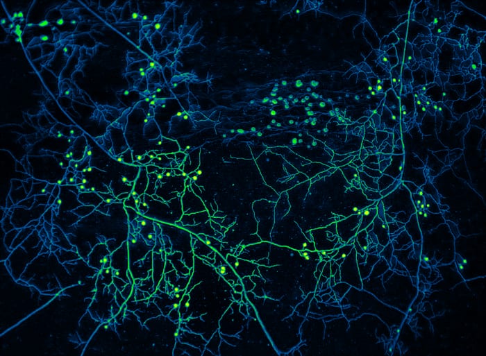False-color micrograph of arbuscular mycorrhizal fungal mycelium showing the thread-like hyphal network with circular spores. The original image is black and white; color added for legibility. Credit: Oyarte-Galvez / AMOLF, CC BY-SA 4.0.